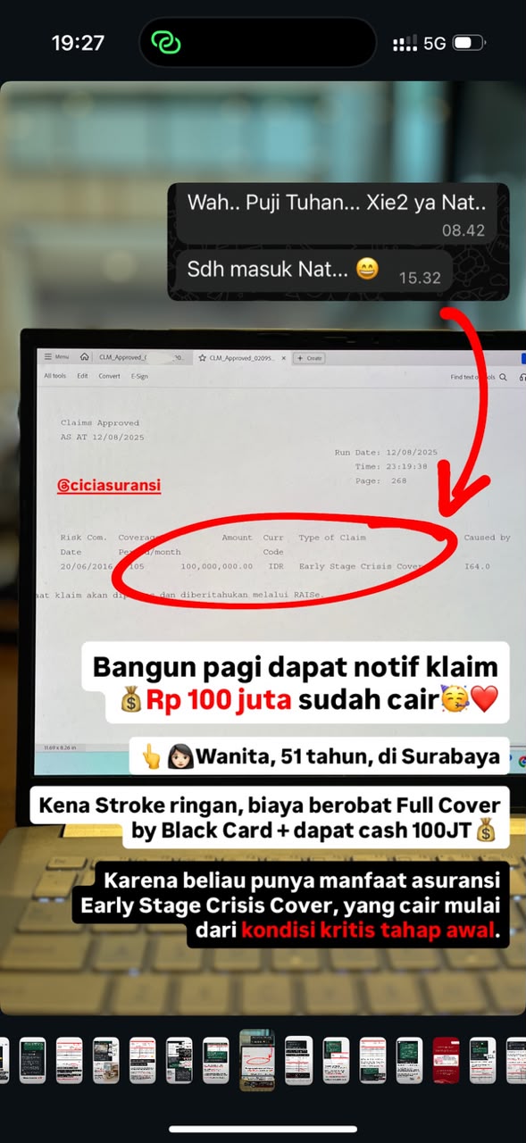 Klaim stroke tahap awal, cash Rp 100 juta cair